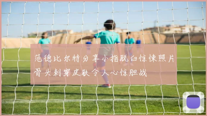 范德比尔特分享小指脱臼惊悚照片骨头刺穿皮肤令人心惊胆战
